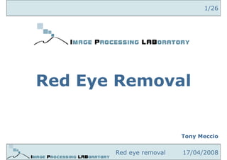 1/26




Red Eye Removal
     y


                         Tony Meccio


       Red eye removal   17/04/2008
 