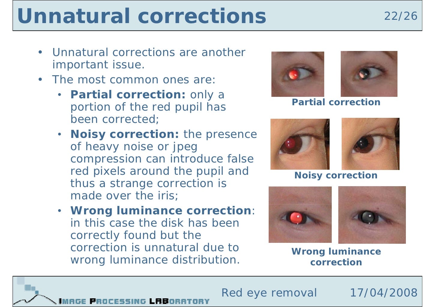 Red Eye Removal
