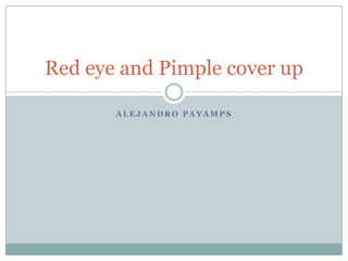 Red eye and Pimple cover up

       ALEJANDRO PAYAMPS
 