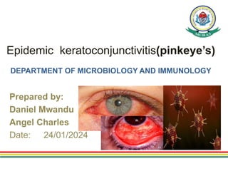 Epidemic keratoconjunctivitis(pinkeye’s)
DEPARTMENT OF MICROBIOLOGY AND IMMUNOLOGY
Prepared by:
Daniel Mwandu
Angel Charles
Date: 24/01/2024
 