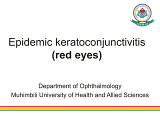 Epidemic keratoconjunctivitis
(red eyes)
Department of Ophthalmology
Muhimbili University of Health and Allied Sciences
 