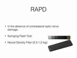 Atypical Optic Neuritis -Red Flags | PPT