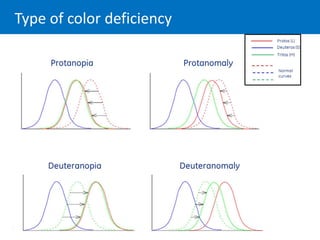 Type of color deficiency
 