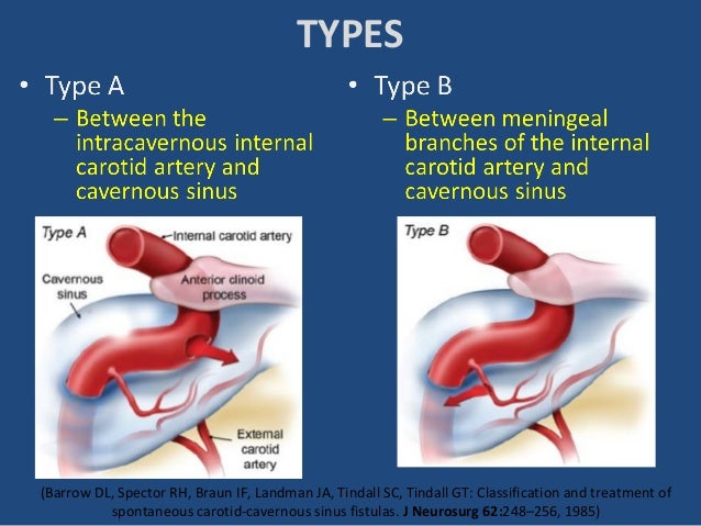 What causes uti in dogs image