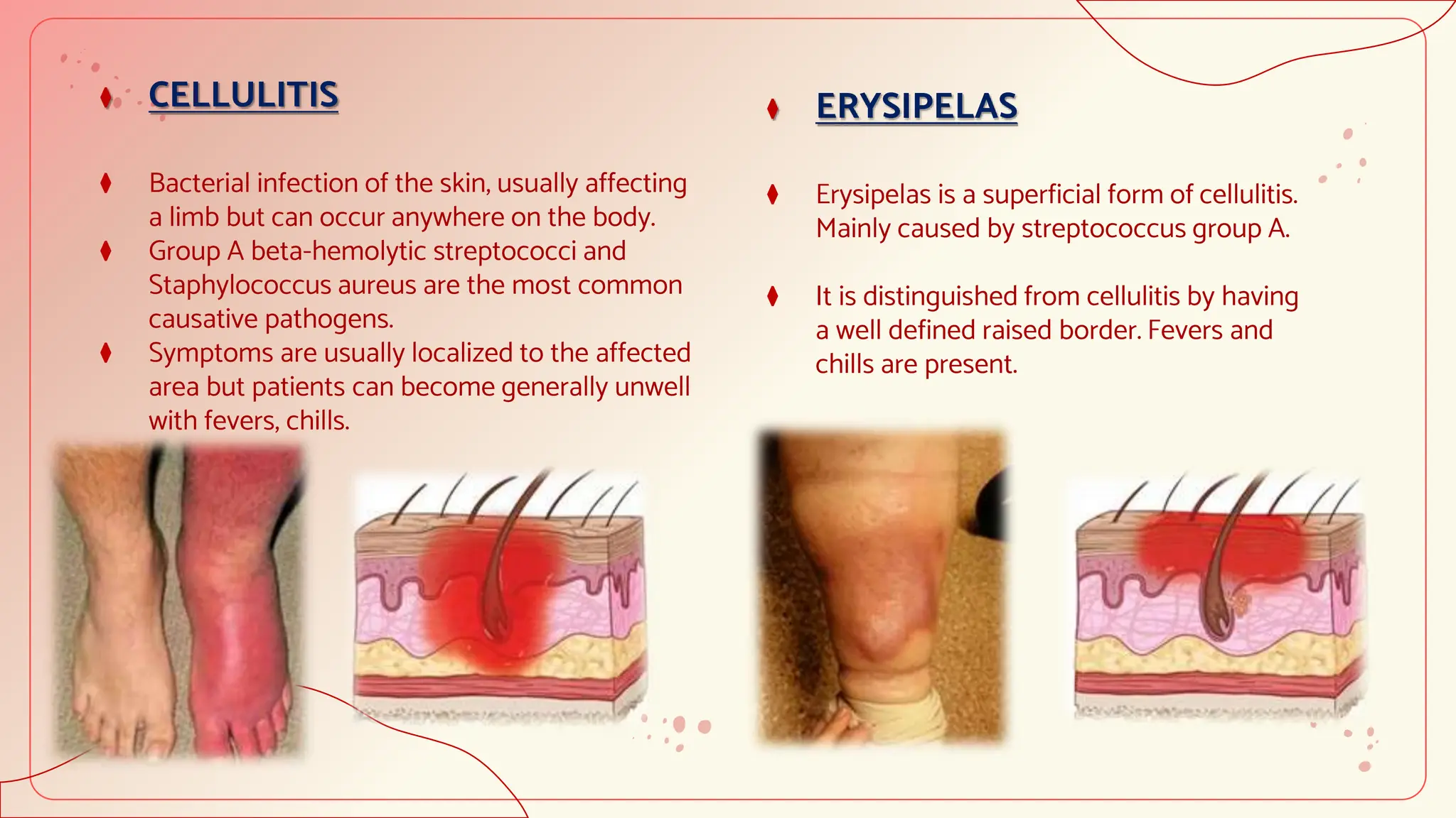 RED LEG PPT DERMATOLOGY PRESENTATION.pptx