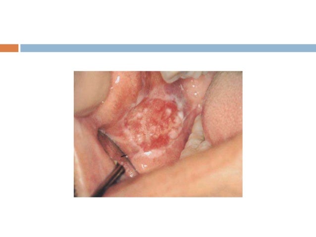 Avitaminosis Causes, Symptoms and Treatment