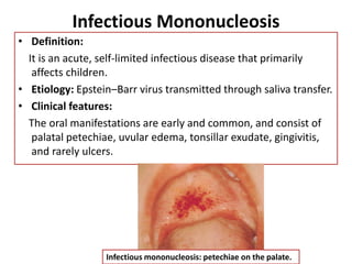 RED LESIONS in oral cavity and it’s feature | PDF