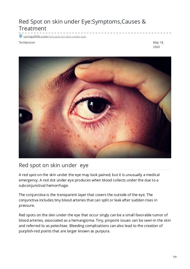 red-spot-on-skin-under-eye