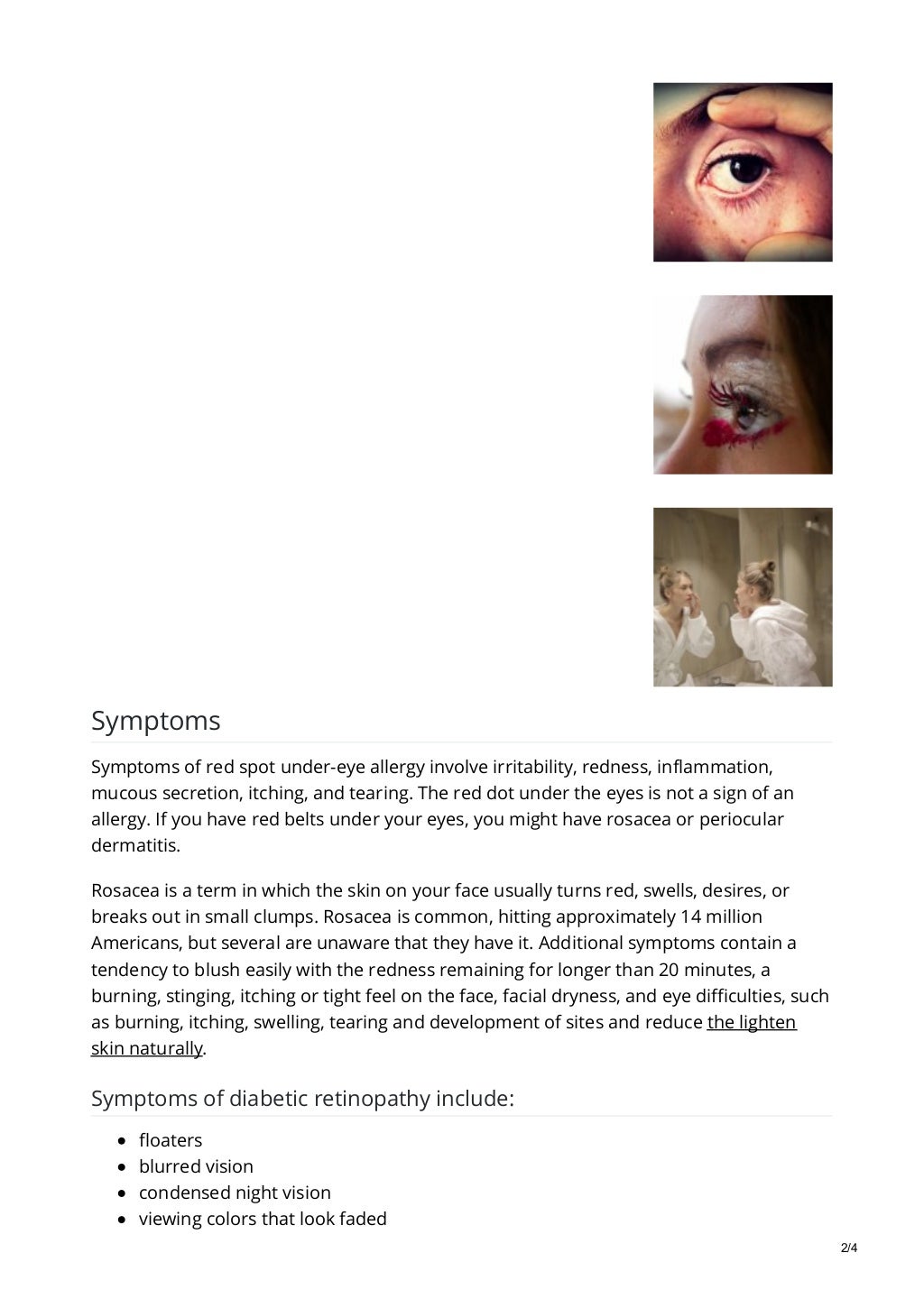 Red spot on skin under eye