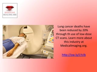 Lung	
  cancer	
  deaths	
  have	
  
been	
  reduced	
  by	
  20%	
  
through	
  th	
  use	
  of	
  low-­‐dose	
  
CT	
  scans.	
  Learn	
  more	
  about	
  
this	
  industry	
  at	
  
MedicalImaging.org.	
  	
  
	
  
h@p://ow.ly/LYclb	
  
 