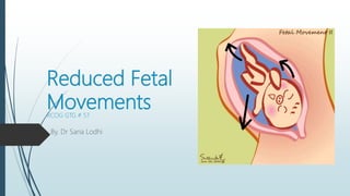 Reduced Fetal
MovementsRCOG GTG # 57
By. Dr Sana Lodhi
 