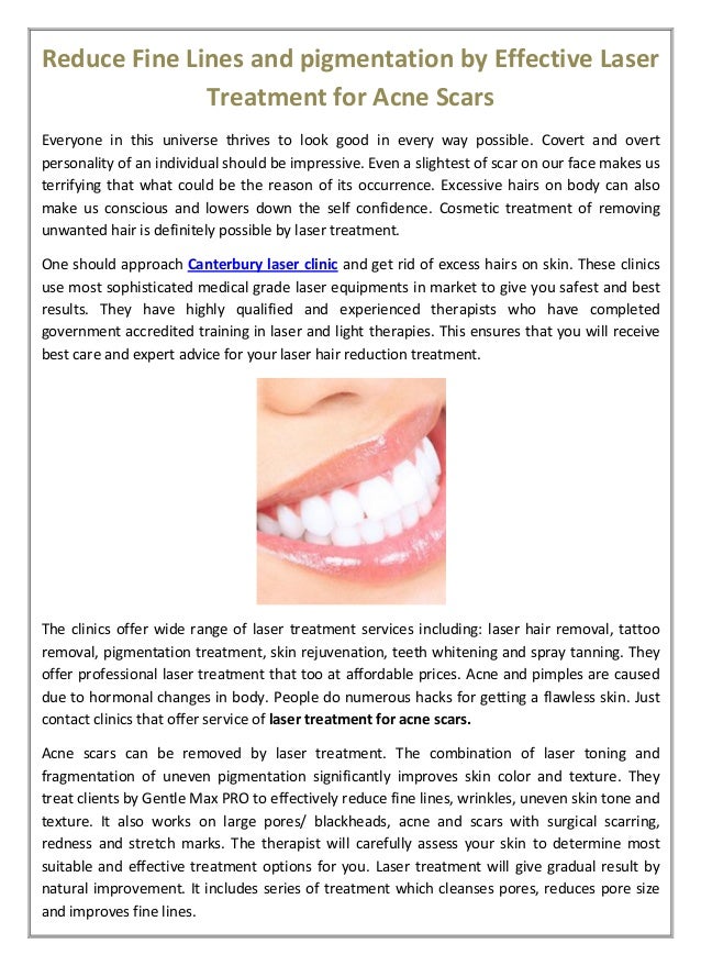 best treatment for acne pigmentation