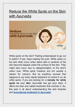 Reduce The White Spots On The Skin With Ayurveda Reduce The White Spots On The Skin With Ayurveda