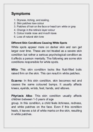 Reduce The White Spots On The Skin With Ayurveda Reduce The White Spots On The Skin With Ayurveda