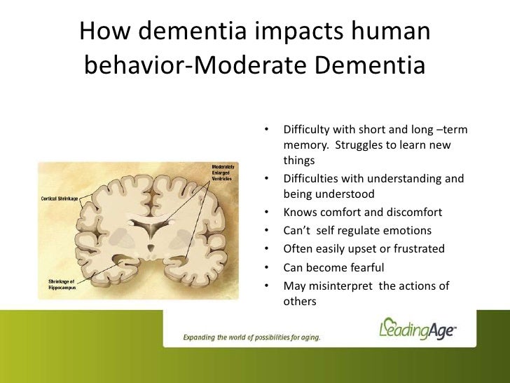 Antivert Is A Medication Used To Reduce