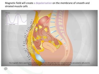 Magnetic	field	will	create	a	depolarisation	on	the	membrane	of	smooth	and	
striated	muscle	cells	
 