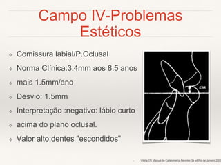 Campo IV-Problemas 
Estéticos 
❖ Comissura labial/P.Oclusal 
❖ Norma Clínica:3.4mm aos 8.5 anos 
❖ mais 1.5mm/ano 
❖ Desvio: 1.5mm 
❖ Interpretação :negativo: lábio curto 
❖ acima do plano oclusal. 
❖ Valor alto:dentes "escondidos" 
❖ Vilella OV.Manual de Cefalometria.Revinter.3a ed.Rio de Janeiro.2009 
 