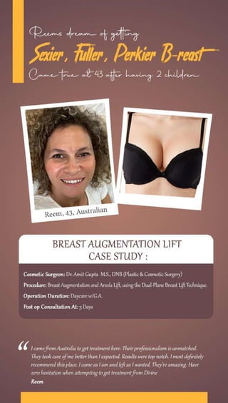 Breast Augmentation Case Study: Implants with Lift Surgery in India