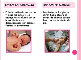 REFLEJO DEL SOBRESALTO            REFLEJO DE BABINSKY


   El bebe extiende los brazos      Los dedos de los pies se
    y luego los dobla y los           abren hacia afuera en
    empuja hacia afuera con un        forma de abanico cuando
    breve llanto esto                 hay roce en la planta del
    desencadenado por sonidos         pie.
    fuertes o movimientos.
 