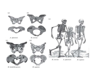 Referat - Bazinul Osos.docx