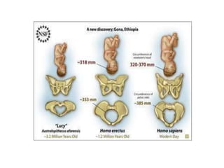 Referat - Bazinul Osos.docx