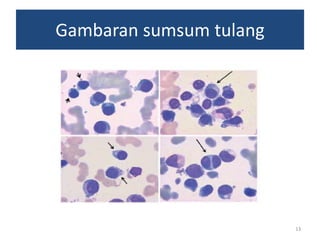Gambaran sumsum tulang

13

 