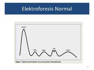 Elektroforesis Normal

15

 