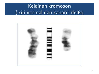 Kelainan kromoson
( kiri normal dan kanan : del6q

24

 