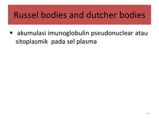 Russel bodies and dutcher bodies
 akumulasi imunoglobulin pseudonuclear atau
sitoplasmik pada sel plasma

46

 