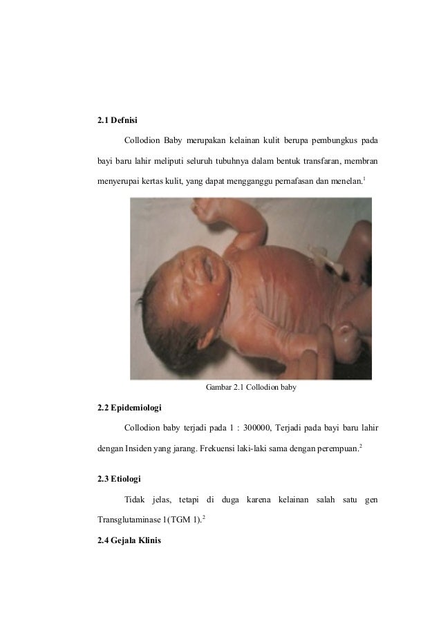 Referat Collodion Baby