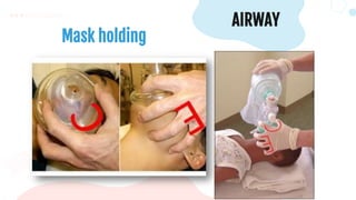 Mask holding
AIRWAY
 