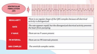 VENTRICULAR
FIBRILLATION
(VF)
 