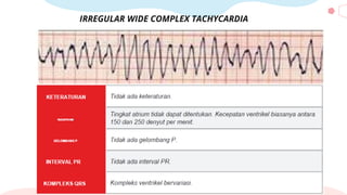 IRREGULAR WIDE COMPLEX TACHYCARDIA
 