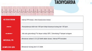 TACHYCARDIA
 