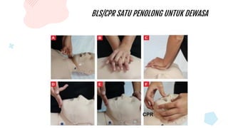 BLS/CPR SATU PENOLONG UNTUK DEWASA
CPR
 