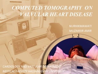 COMPUTED TOMOGRAPHY ON 
VALVULAR HEART DISEASE 
NURHIKMAWATI 
MUZAKKIR AMIR 
CARDIOLOGY AND VASCULAR DEPARTMENT 
MEDICAL FACULTY HASSANUDDIN UNIVERSITY 
 
