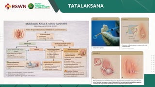Referat tentang kista bartholini Obgyn.pdf