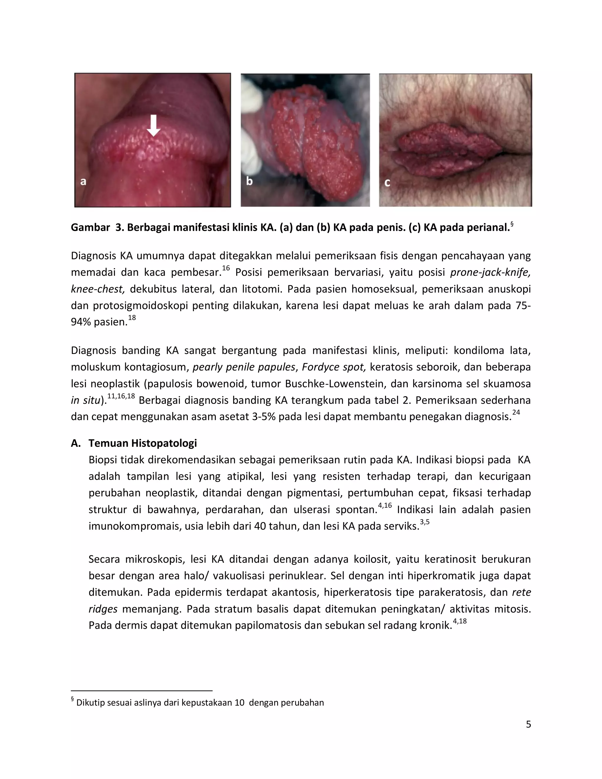 Porno etuk eshaklar tan olishadi Jinsiy aloqada birinchi on yillikning qizi