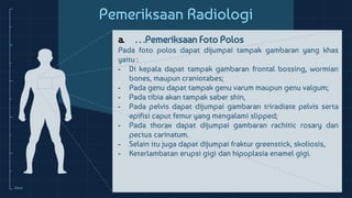 Kaki Rakhitis Referat Radiologi Rickets (Rakhitis) | PPTX