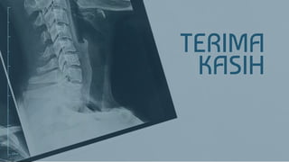 Kaki Rakhitis Referat Radiologi Rickets (Rakhitis) | PPTX