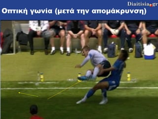 Οπτική γωνία (μετά την απομάκρυνση) 