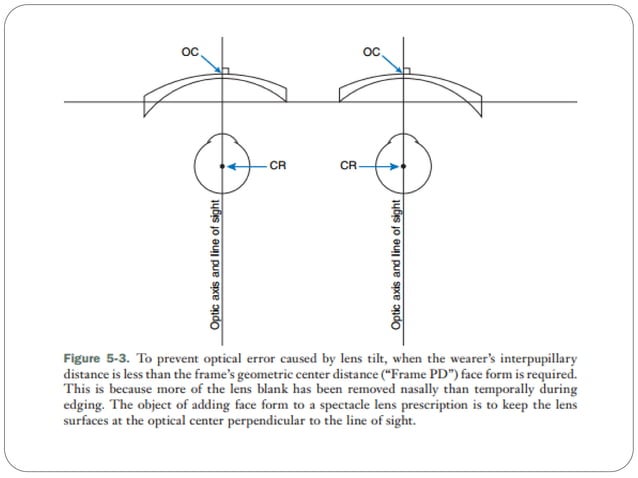 Reference point placement, multi focal height and blank size ...