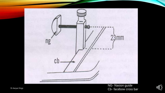 Reference points for facebow | PPTX