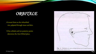 ORBITALE
•Lowest Point on the infraorbital
rim, palpated through tissue and skin.
•One orbitale and two posterior points
determine the Axis-Orbital plane.
Dr Aaryas Vlogs
 