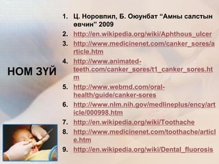1. Ц. Норовпил, Б. Оюунбат “Амны салстын
өвчин” 2009
2. http://en.wikipedia.org/wiki/Aphthous_ulcer
3. http://www.medicinenet.com/canker_sores/a
rticle.htm
4. http://www.animated-
teeth.com/canker_sores/t1_canker_sores.ht
m
5. http://www.webmd.com/oral-
health/guide/canker-sores
6. http://www.nlm.nih.gov/medlineplus/ency/art
icle/000998.htm
7. http://en.wikipedia.org/wiki/Toothache
8. http://www.medicinenet.com/toothache/articl
e.htm
9. http://en.wikipedia.org/wiki/Dental_fluorosis
НОМ ЗҮЙ
 