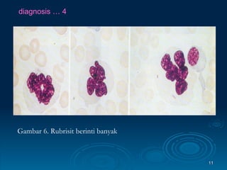 diagnosis … 4 Gambar 6. Rubrisit berinti banyak 