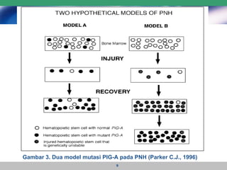 Gambar 3. Dua model mutasi PIG-A pada PNH (Parker C.J., 1996) 
