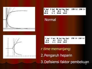 Normal  r time  memanjang : Pengaruh heparin Defisiensi faktor pembekuan 