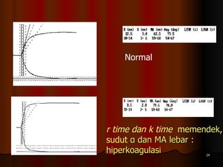 Normal  r time dan k time  memendek, sudut  α dan MA lebar : hiperkoagulasi 