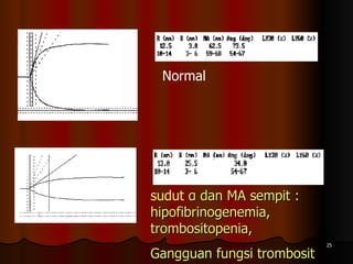 Normal  sudut  α dan MA sempit : hipofibrinogenemia, trombositopenia,  Gangguan fungsi trombosit 
